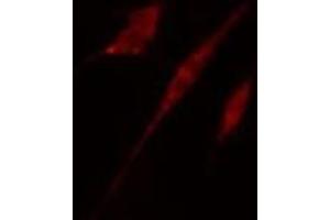 ABIN6278650 staining HT29 cells by IF/ICC. (CSNK1A1 antibody  (pTyr294))