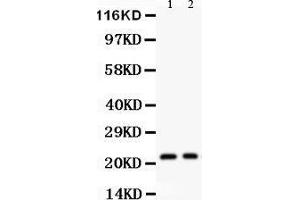 Western Blotting (WB) image for anti-Interleukin 18 (IL18) (AA 37-193) antibody (ABIN3044311) (IL-18 antibody  (AA 37-193))