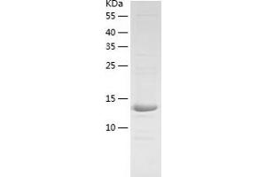 Western Blotting (WB) image for Hephaestin (HEPH) (AA 968-1124) protein (His tag) (ABIN7288555) (Hephaestin Protein (HEPH) (AA 968-1124) (His tag))