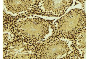ABIN6268876 at 1/100 staining Mouse testis tissue by IHC-P. (PIAS4 antibody  (C-Term))