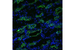 Immunohistochemistry analysis using Rabbit Anti-Aquaporin 3 Polyclonal Antibody . (AQP3 antibody  (C-Term))