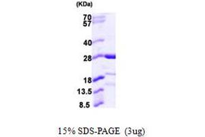 Calcyphosine-Like (CAPSL) (AA 1-208) protein (His tag)