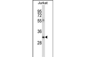 CD7 Antibody (Center) (ABIN657637 and ABIN2846633) western blot analysis in Jurkat cell line lysates (35 μg/lane). (CD7 antibody  (AA 63-92))