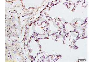 Formalin-fixed and rat lung tissue labeled with Anti-IQGAP1 Polyclonal Antibody, Unconjugated (ABIN737796) at 1:200 followed by conjugation to the secondary antibody and DAB staining (IQGAP1 antibody  (AA 1451-1550))