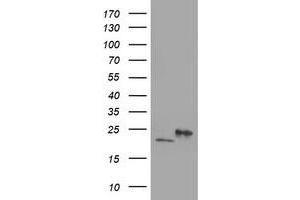 HEK293T cells were transfected with the pCMV6-ENTRY control (Left lane) or pCMV6-ENTRY DHFRL1 (Right lane) cDNA for 48 hrs and lysed. (DHFRL1 antibody  (AA 4-185))