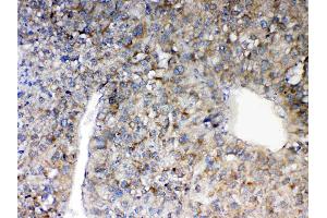 IHC analysis of MAVS using anti-MAVS antibody . (MAVS antibody  (AA 34-96))