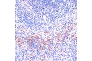 Immunohistochemistry (IHC) image for anti-Perforin 1 (Pore Forming Protein) (PRF1) (AA 280-555) antibody (ABIN3020642)