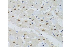 Immunohistochemistry (Paraffin-embedded Sections) (IHC (p)) image for anti-Damage Specific DNA Binding Protein 1 (DDB1) antibody (ABIN7260707)
