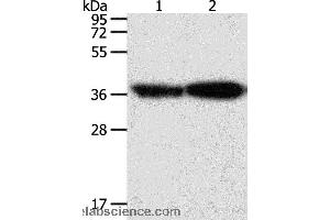 Western blot analysis of Human leiomyosarcoma and mouse testis tissue, using TPM2 Polyclonal Antibody at dilution of 1:1000