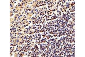 Immunohistochemical analysis of paraffin-embedded human spleen using b-Actin antibody at 1:25 dilution. (beta Actin antibody)