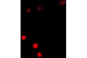 Immunofluorescent analysis of SSX5 staining in A549 cells. (SSX5 antibody)