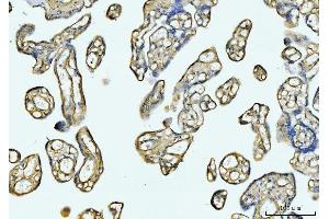 IHC analysis of COL6A1 using anti-COL6A1 antibody (ABIN7600515).
