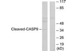 Western blot analysis of extracts from HeLa cells, treated with Etoposide 25uM 60', using Caspase 9 (Cleaved-Asp330) Antibody.