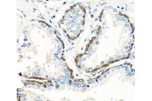 Immunohistochemistry (Paraffin-embedded Sections) (IHC (p)) image for anti-Bone Morphogenetic Protein 5 (BMP5) antibody (ABIN7264429)