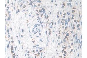 Immunohistochemistry (IHC) image for anti-Kallikrein 11 (KLK11) (AA 39-282) antibody (ABIN7432349)