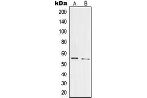 Western blot analysis of PRPF19 expression in HepG2 (A), HeLa (B) whole cell lysates. (PRP19 antibody  (Center))