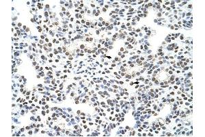HNRPA3 antibody was used for immunohistochemistry at a concentration of 4-8 ug/ml to stain Alveolar cells (arrows) in Human Lung. (HNRNPA3 antibody  (N-Term))