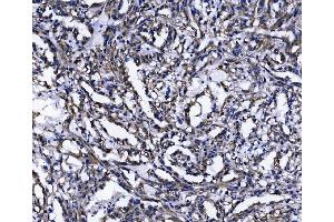 IHC analysis of TOMM70 using anti-TOMM70 antibody (ABIN7599855). (TOM70 antibody  (AA 122-608))