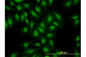 Immunofluorescence of monoclonal antibody to S100A13 on HeLa cell. (S100A13 antibody  (AA 1-98))