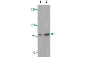 Western blot analysis of FREM2 in A-20 cell lysate with FREM2 polyclonal antibody  at (1) 0. (FREM2 antibody  (Internal Region))