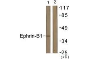 Western blot analysis of extracts from COS7 cells, using EFNB1 (Ab-317) Antibody. (Ephrin B1 antibody  (AA 283-332))