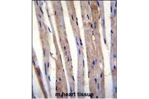 KRT73 Antibody (C-term) (ABIN655195 and ABIN2844811) immunohistochemistry analysis in formalin fixed and paraffin embedded m. (KRT73 antibody  (C-Term))