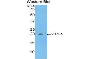 Western Blotting (WB) image for anti-Caspase 8 (CASP8) (AA 25-175) antibody (ABIN1077918)