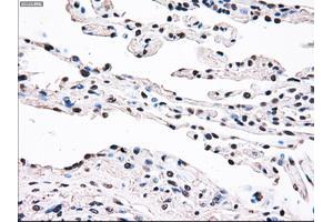 Immunohistochemical staining of paraffin-embedded prostate tissue using anti-SSBmouse monoclonal antibody. (SSB antibody)
