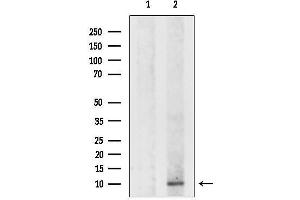 Western blot analysis of lysates from F10 cells, using DSS1 Antibody.