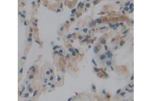 IHC-P analysis of Human Tissue, with DAB staining. (PLA2G4A antibody  (AA 1-178))