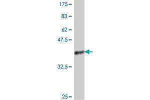 Western Blot detection against Immunogen (37. (PSMB3 antibody  (AA 106-205))