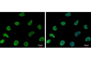 ICC/IF Image DNAJB6 antibody [N3C3] detects DNAJB6 protein at nucleus by immunofluorescent analysis. (DNAJB6 antibody  (Center))