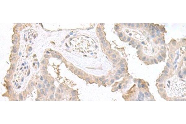 Double-stranded RNA-binding protein Staufen homolog 2 (STAU2) antibody