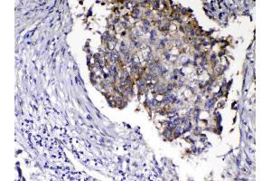 IHC analysis of Relaxin 1 using anti-Relaxin 1 antibody . (Relaxin 1 antibody)
