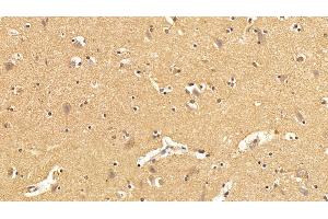 Detection of TXNIP in Human Cerebrum Tissue using Polyclonal Antibody to Thioredoxin-interacting Protein (TXNIP) (TXNIP antibody  (AA 32-367))