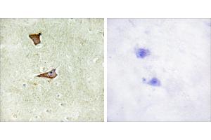 Immunohistochemistry analysis of paraffin-embedded human brain tissue using IGF2R (Phospho-Ser2409) antibody. (IGF2R antibody  (pSer2409))