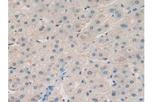 Detection of aZGP1 in Human Liver Tissue using Polyclonal Antibody to Alpha-2-Glycoprotein 1, Zinc Binding (aZGP1) (AZGP1 antibody  (AA 180-298))