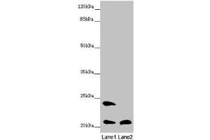 Western blot All lanes: MSRB3 antibody at 8.