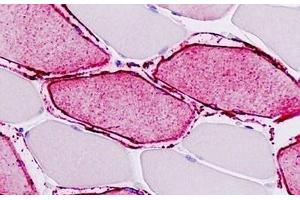Human Skeletal Muscle: Formalin-Fixed, Paraffin-Embedded (FFPE) (ATP2A1/SERCA1 antibody  (AA 548-597))