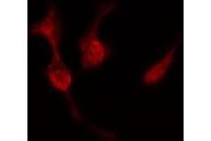 ABIN6277519 staining  Hela cells by IF/ICC. (PRKACB antibody  (C-Term))