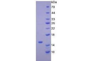 Image no. 1 for Natriuretic Peptides B (NPPB) (AA 27-121) protein (His tag) (ABIN4988453)