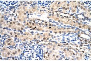 Human kidney (SULF2 antibody  (C-Term))