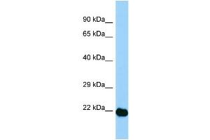 WB Suggested Anti-Aes Antibody Titration: 1. (AES antibody  (N-Term))