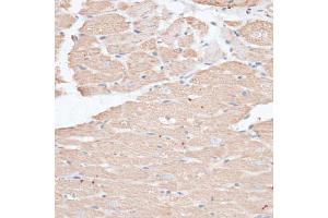 Immunohistochemistry of paraffin-embedded rat heart using ABCC5 antibody (ABIN6291734) at dilution of 1:100 (40x lens). (ABCC5 antibody)