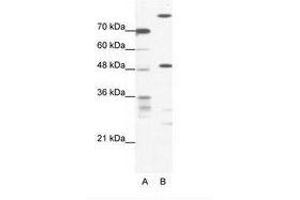 Image no. 1 for anti-NFS1, Cysteine Desulfurase (NFS1) (AA 151-200) antibody (ABIN202565) (NFS1 antibody  (AA 151-200))