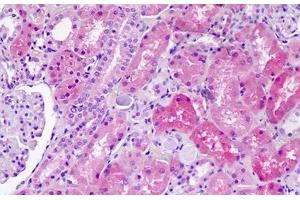 Human Kidney: Formalin-Fixed, Paraffin-Embedded (FFPE) (SLC36A1 antibody  (AA 1-30))