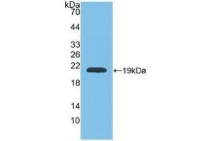 Detection of Recombinant MMP9, Rat using Polyclonal Antibody to Matrix Metalloproteinase 9 (MMP9) (MMP 9 antibody  (AA 226-391))