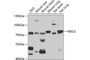 Western blot analysis of extracts of various cell lines, using FBXL5 antibody (ABIN6130378, ABIN6140510, ABIN6140511 and ABIN6221239) at 1:1000 dilution. (FBXL5 antibody  (AA 1-310))