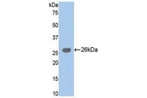 Western Blotting (WB) image for Trypsin ELISA Kit (ABIN6574150)