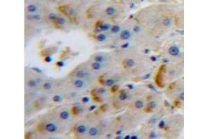 Used in DAB staining on fromalin fixed paraffin-embedded Liver tissue (FURIN antibody  (AA 385-500))